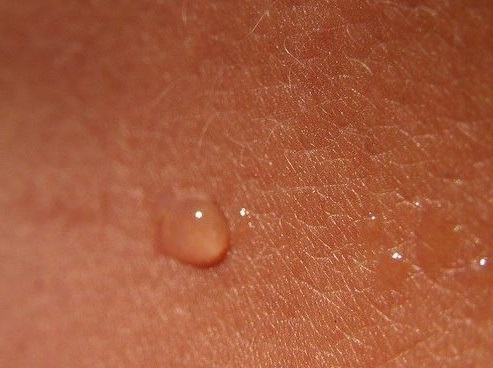 causas de la piel seca