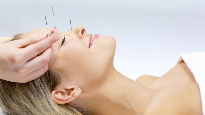 la acupuntura cosmetica se ha convertido en un tratamiento facial muy efectivo