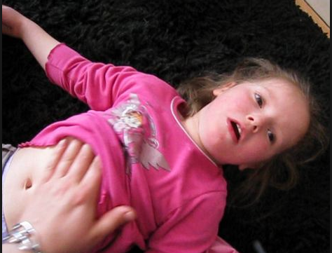 que factores desencadenan la epilepsia infantil