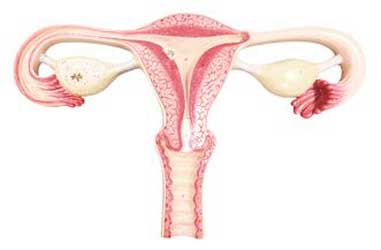 endometrio engrosado o hiperplasia endometrial